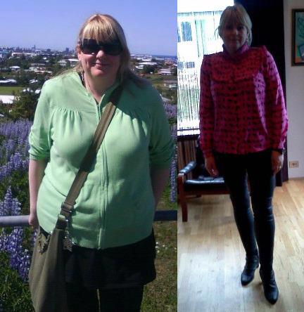 Mæli með að breyta um lífstíl  Henda öllum megrunarkúrum út um gluggann... Og fara hreyfa sig af viti  Á milli þessa mynda eru 34 kíló .